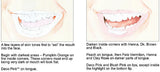 smART Card Mouth Set - Portrait Guide